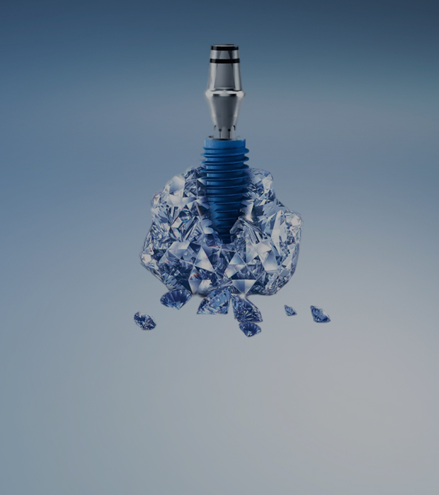 임플란트 관련 이미지